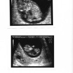 FirstScan01